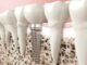 Dental Implants | Cannon Hill Smiles