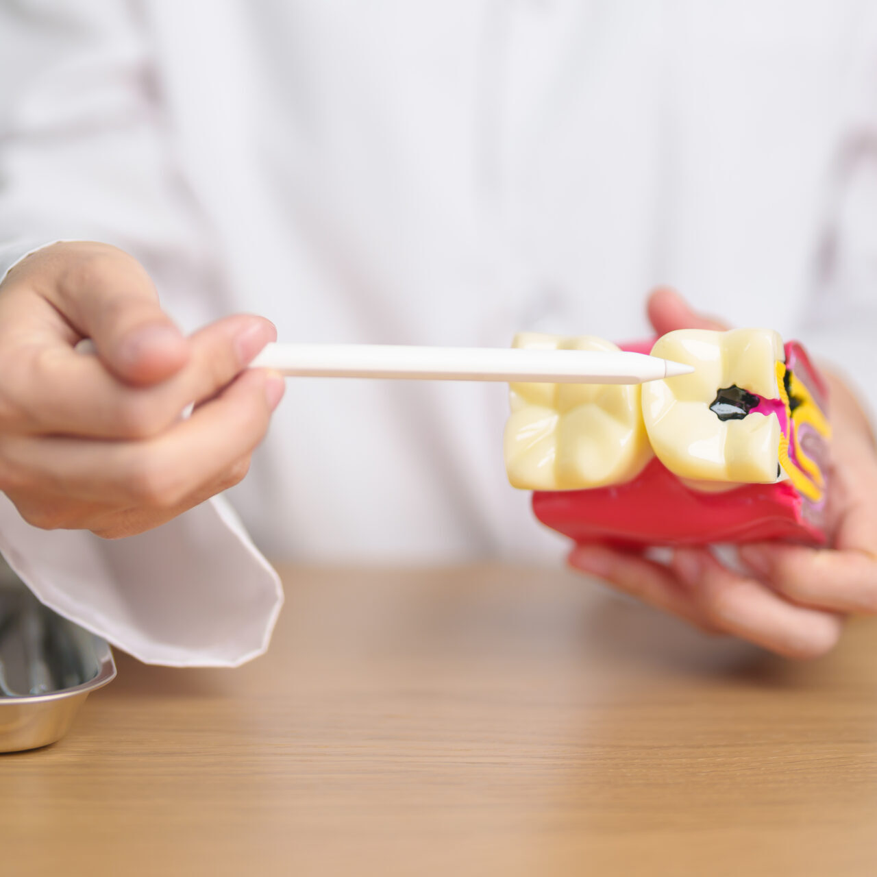 dental fillings in brisbane with cannon hill dentist