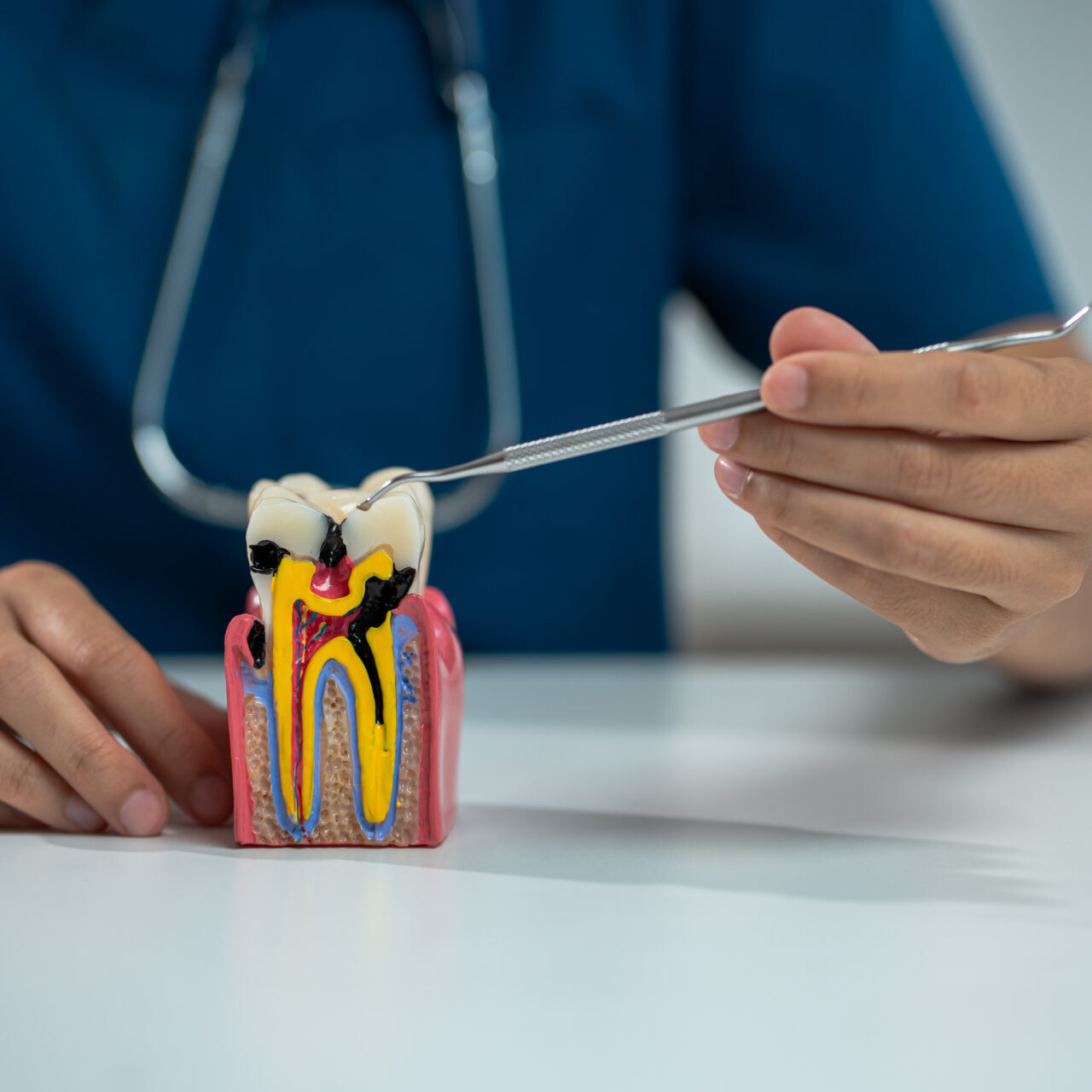 cannon hill dentist explaining root canal treatment brisbane