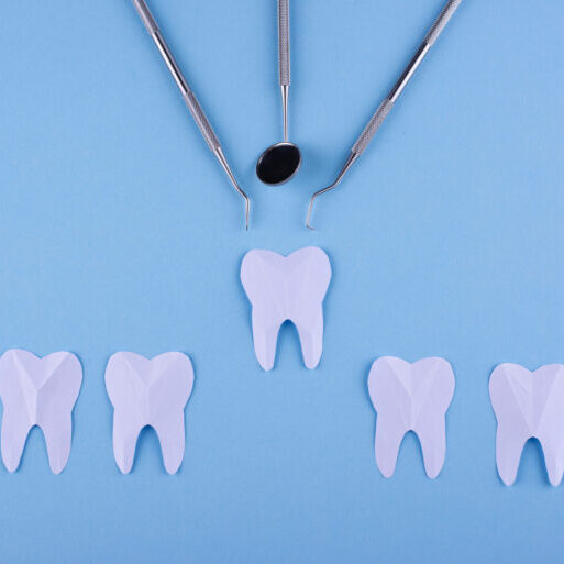 tooth removal in brisbane | cannon hill dentist - tooth extraction in cannon hill