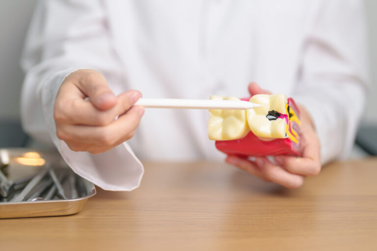 dental fillings in brisbane with cannon hill dentist