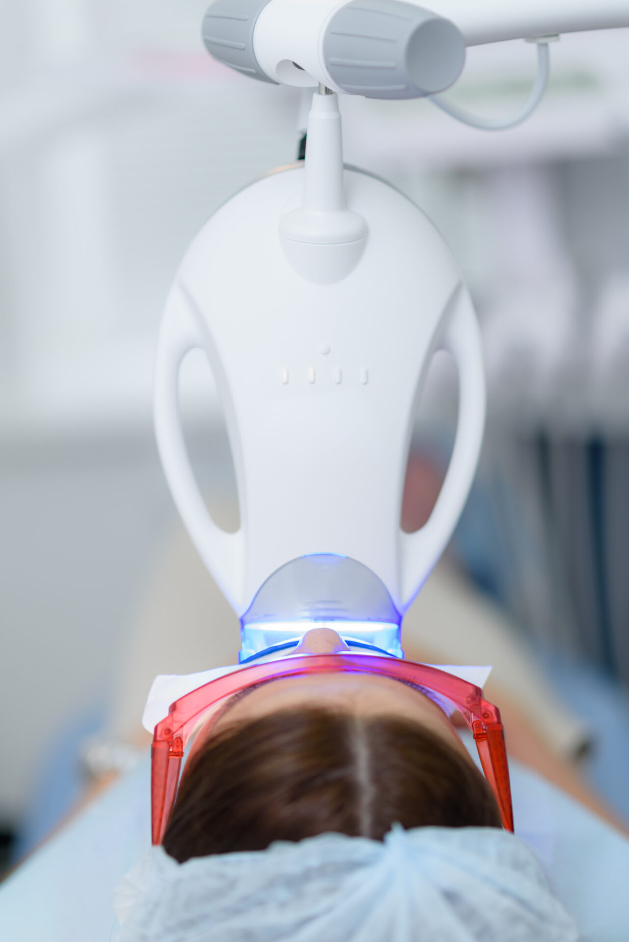 teeth whitening in cannon hill - dentist in-chair teeth whitening brisbane